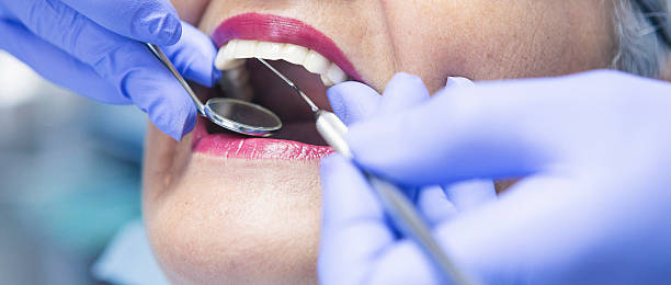 Best Emergency Denture Repair in Port Orchard, WA