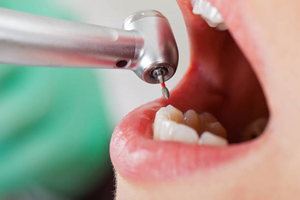 Best Emergency Gum Treatment in Port Orchard, WA